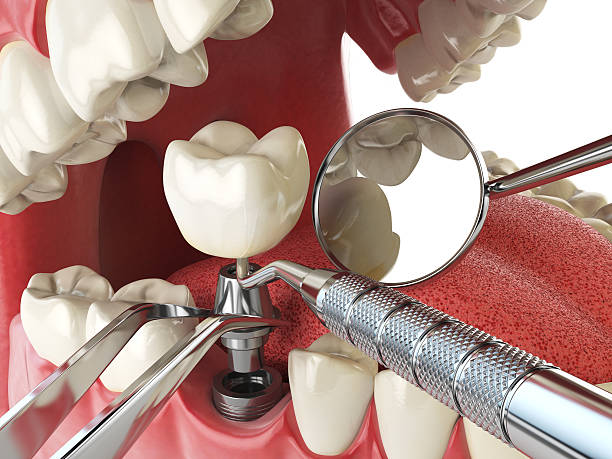 Best Root Canal Emergency Dentist  in Erwinville, LA